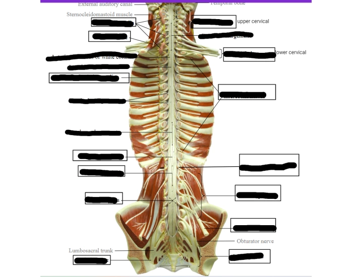 Strach Rack Humans Rack of human Quiz