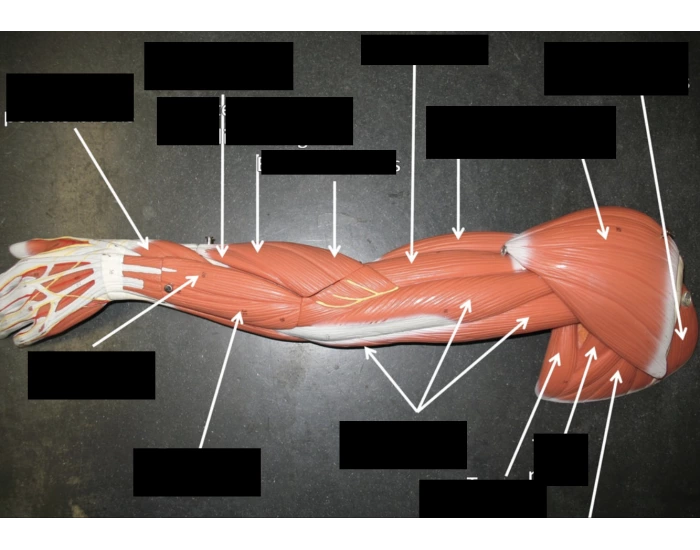 Arm Model Example Arm/forearm muscles Quiz