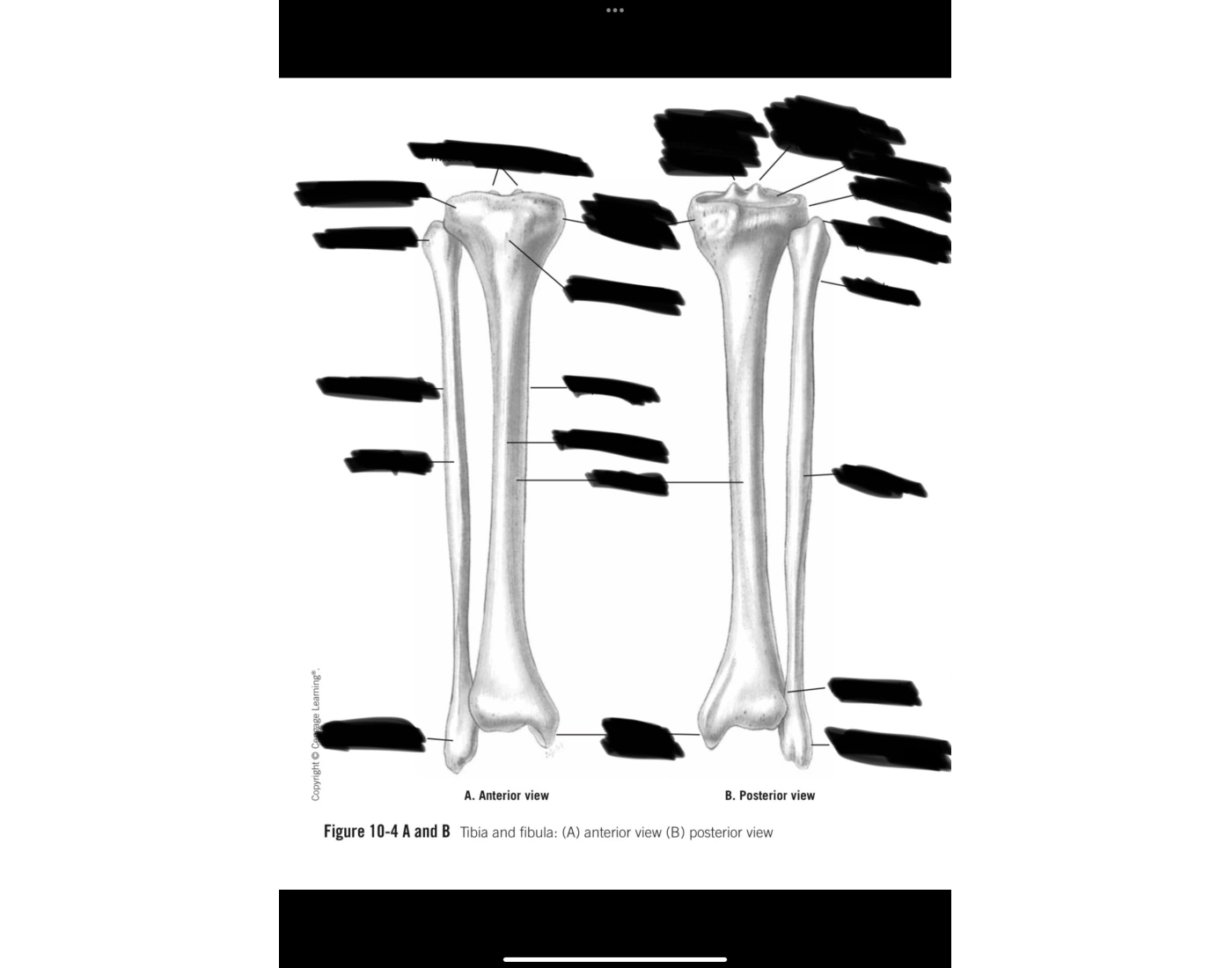 Tib/fib labeling Quiz