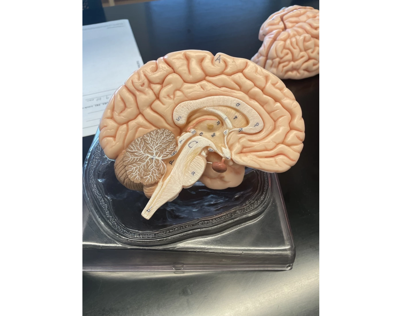 Human Whole Brain Model Quiz Human whole brain model quiz