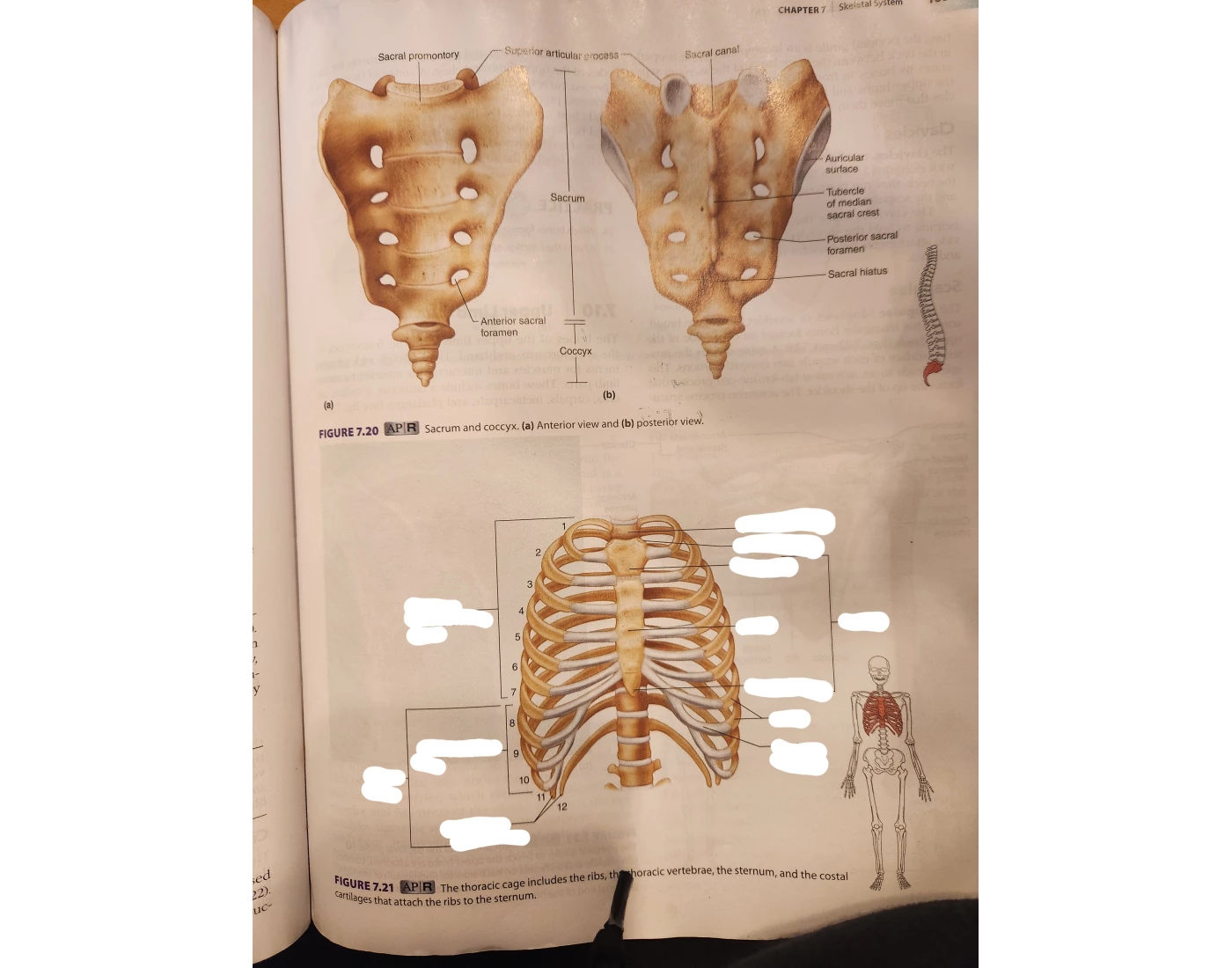 Label the diagram of the ribs Quiz