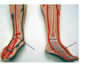 Blood vessels - Arteries in feet