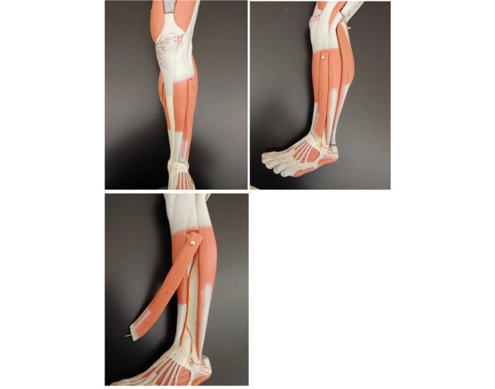 Anterior And Lateral Lower Leg Muscles Quiz Anterior and lateral lower leg muscles quiz