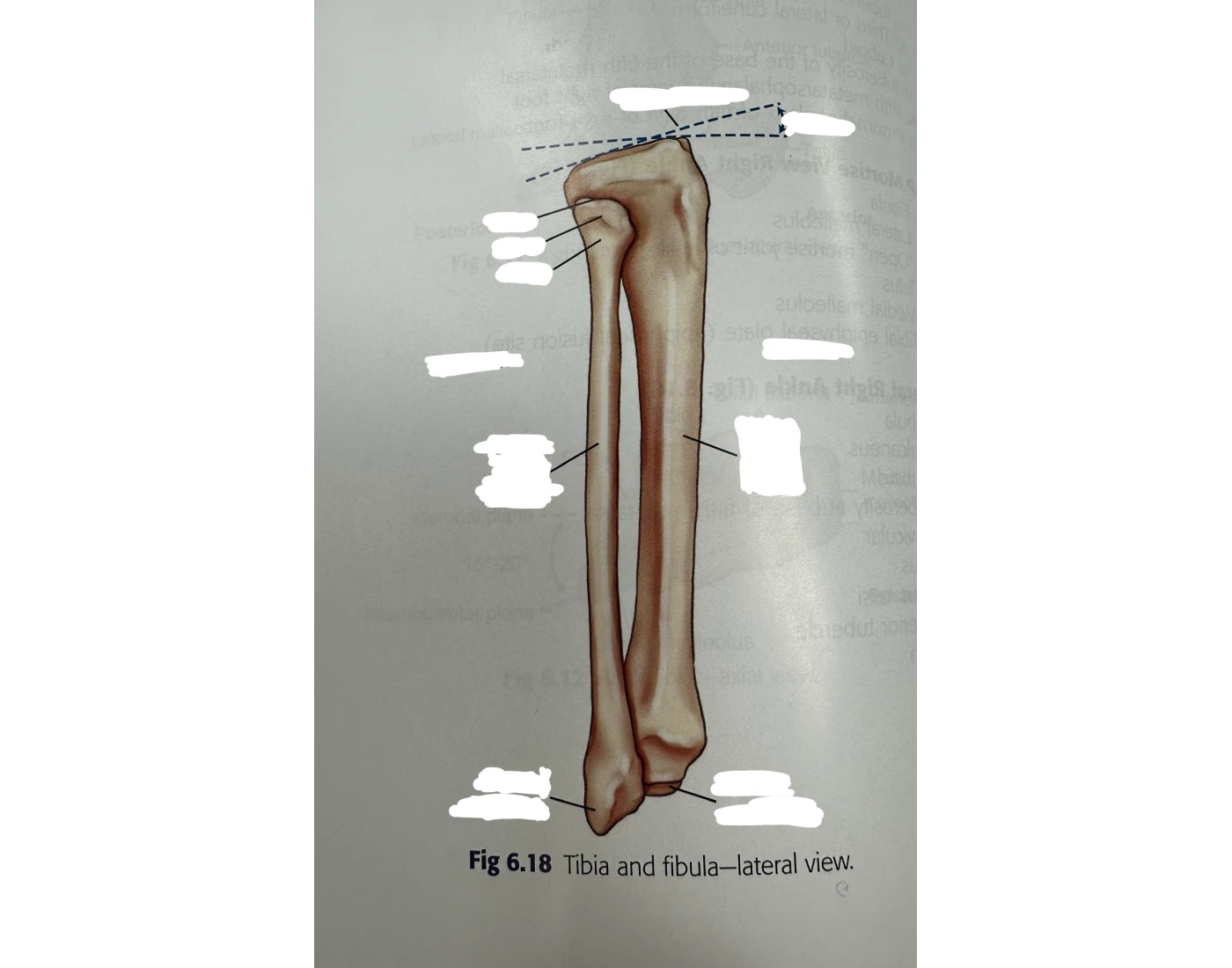 Tibia and fibula - lateral view — Printable Worksheet
