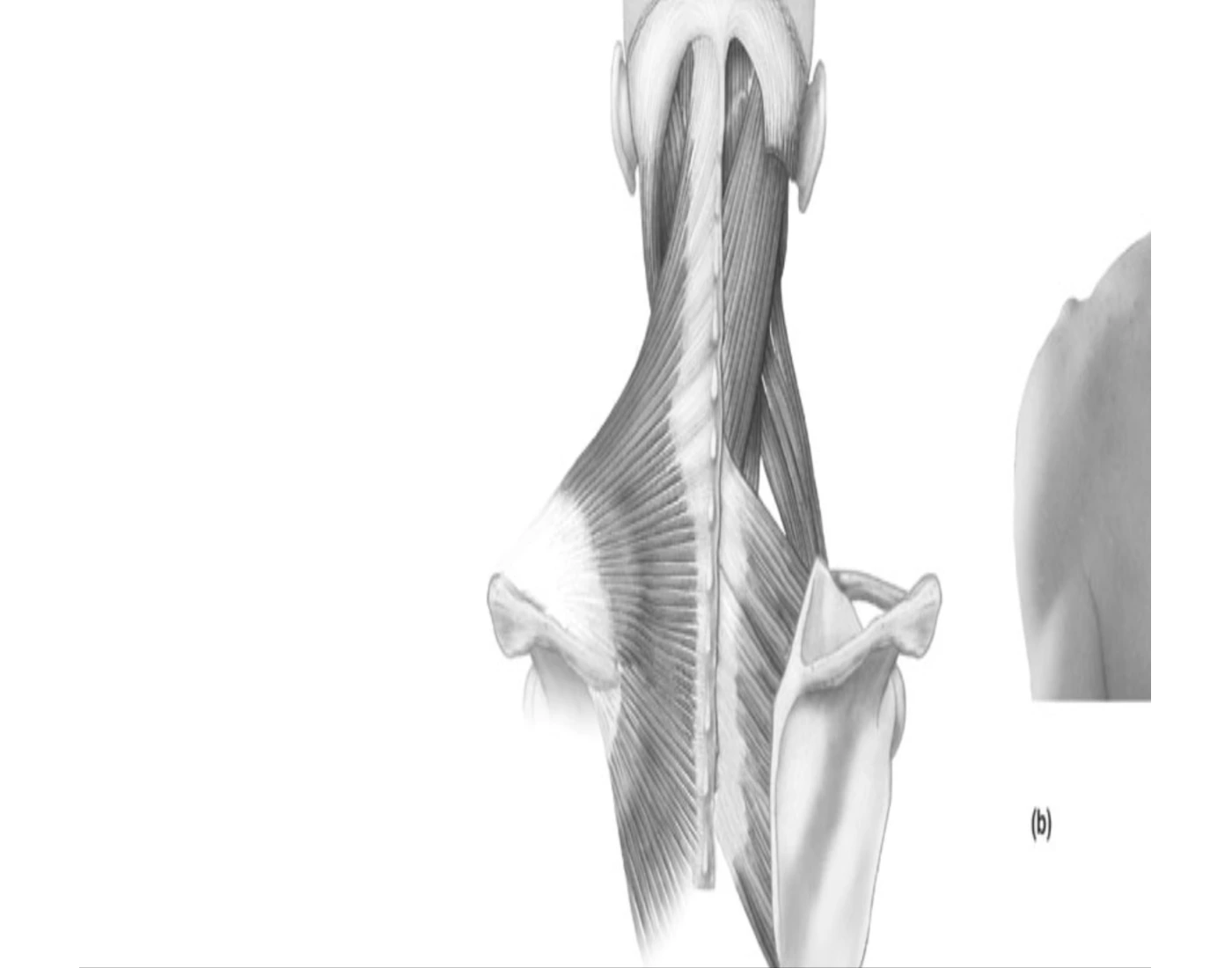 neck-and-upper-back-muscles-quiz