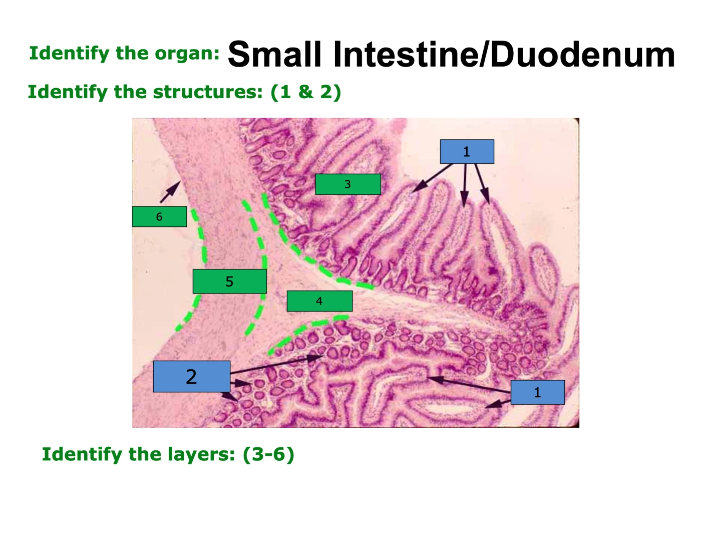 Small intestine/duodenum histology Quiz