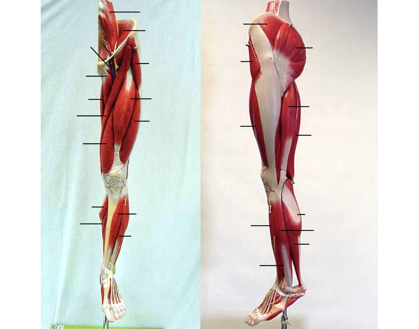 Leg Muscles Anterior And Lateral View Quiz