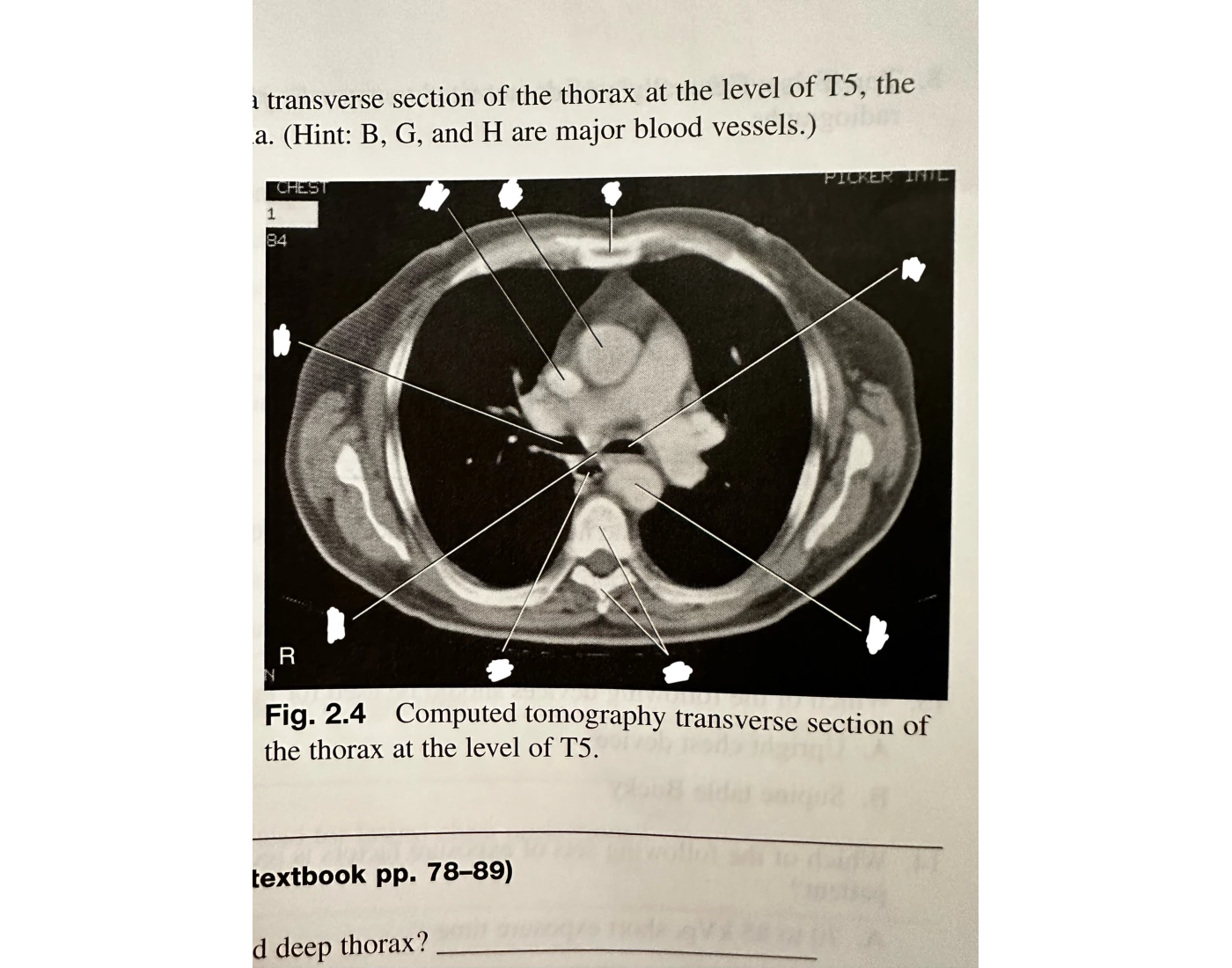Ct Scan Worksheet.pdf CT of thorax — Printable Worksheet