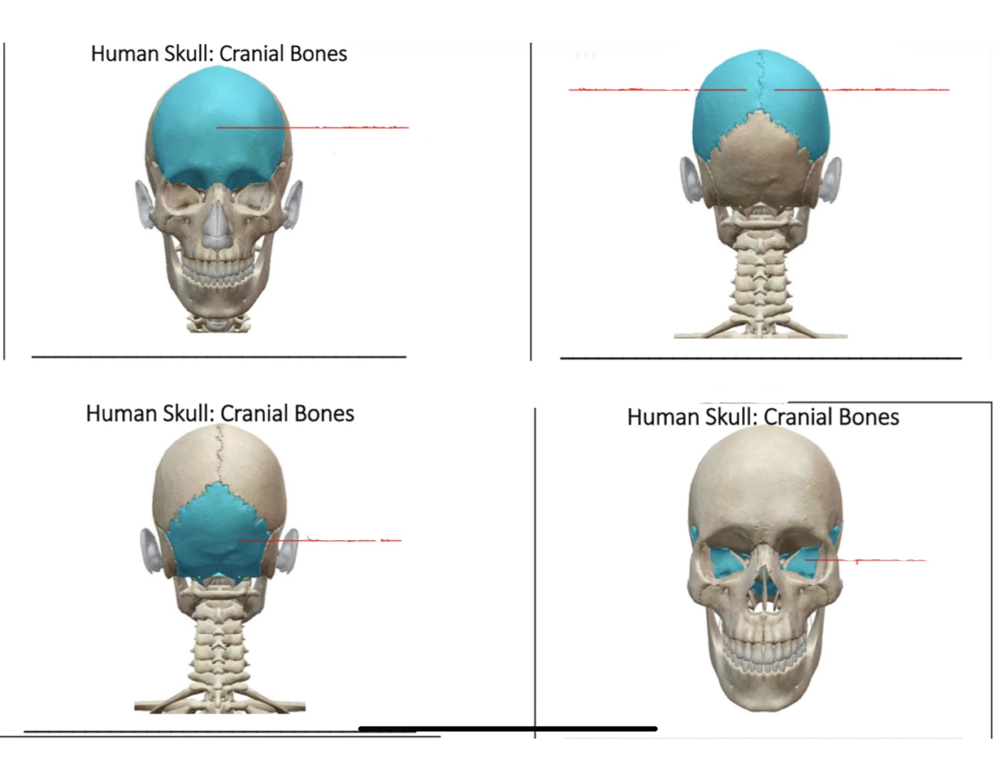 Part 1 Cranial Bones Quiz
