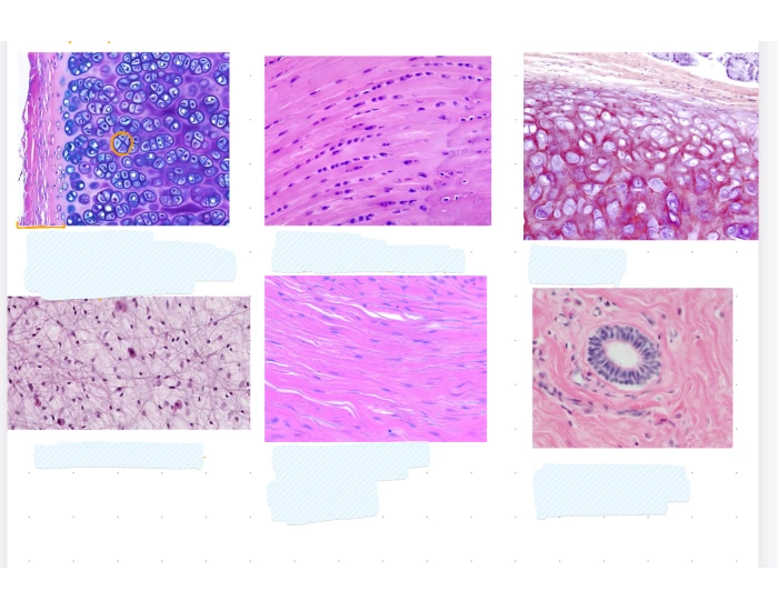 Cartilage and connective tissue Quiz