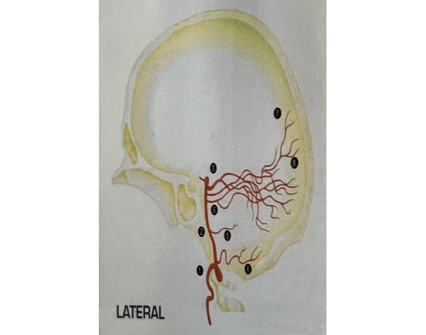 Lateral Vertebral Arteries (VI Review) Quiz