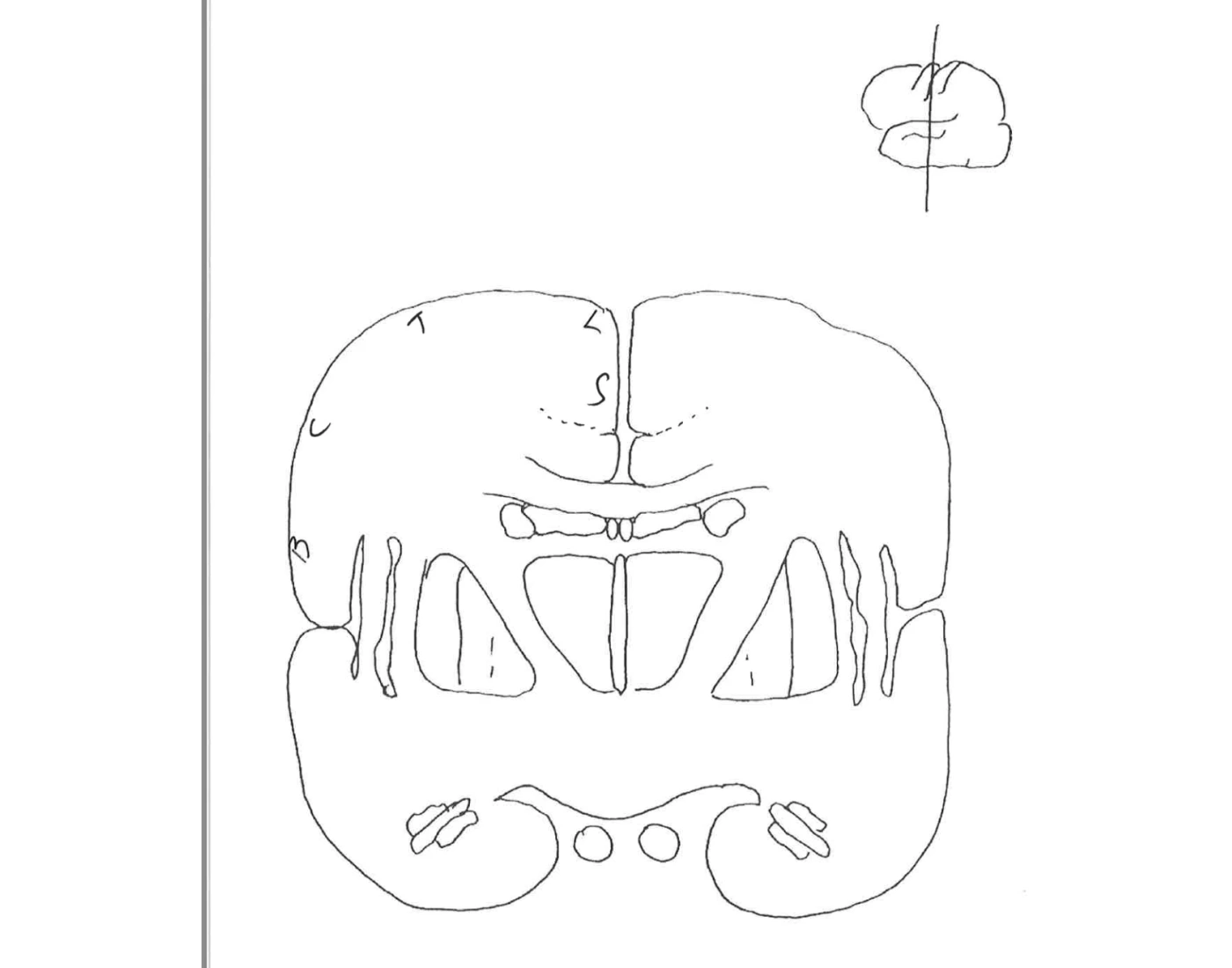 Brain Labelling Frontal View Quiz brain-labelling-frontal-view-quiz