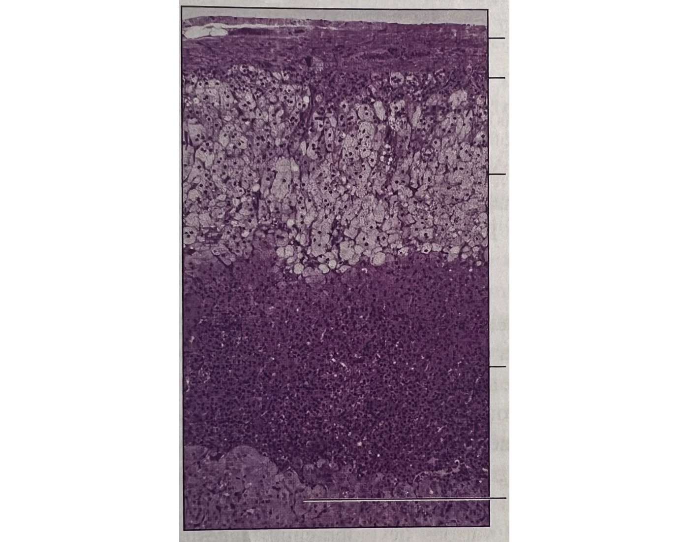 Adrenal cortex and adrenal medulla Biology Diagrams