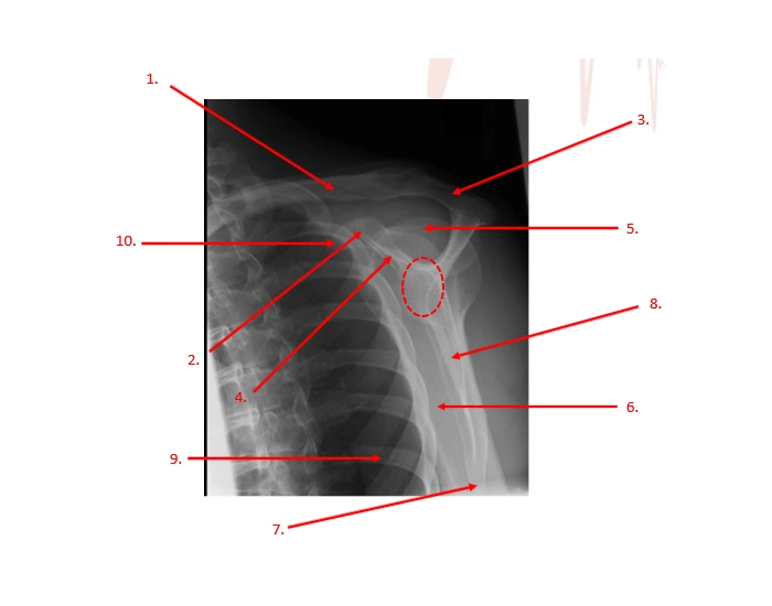 Lateral Shoulder Anatomy Quiz