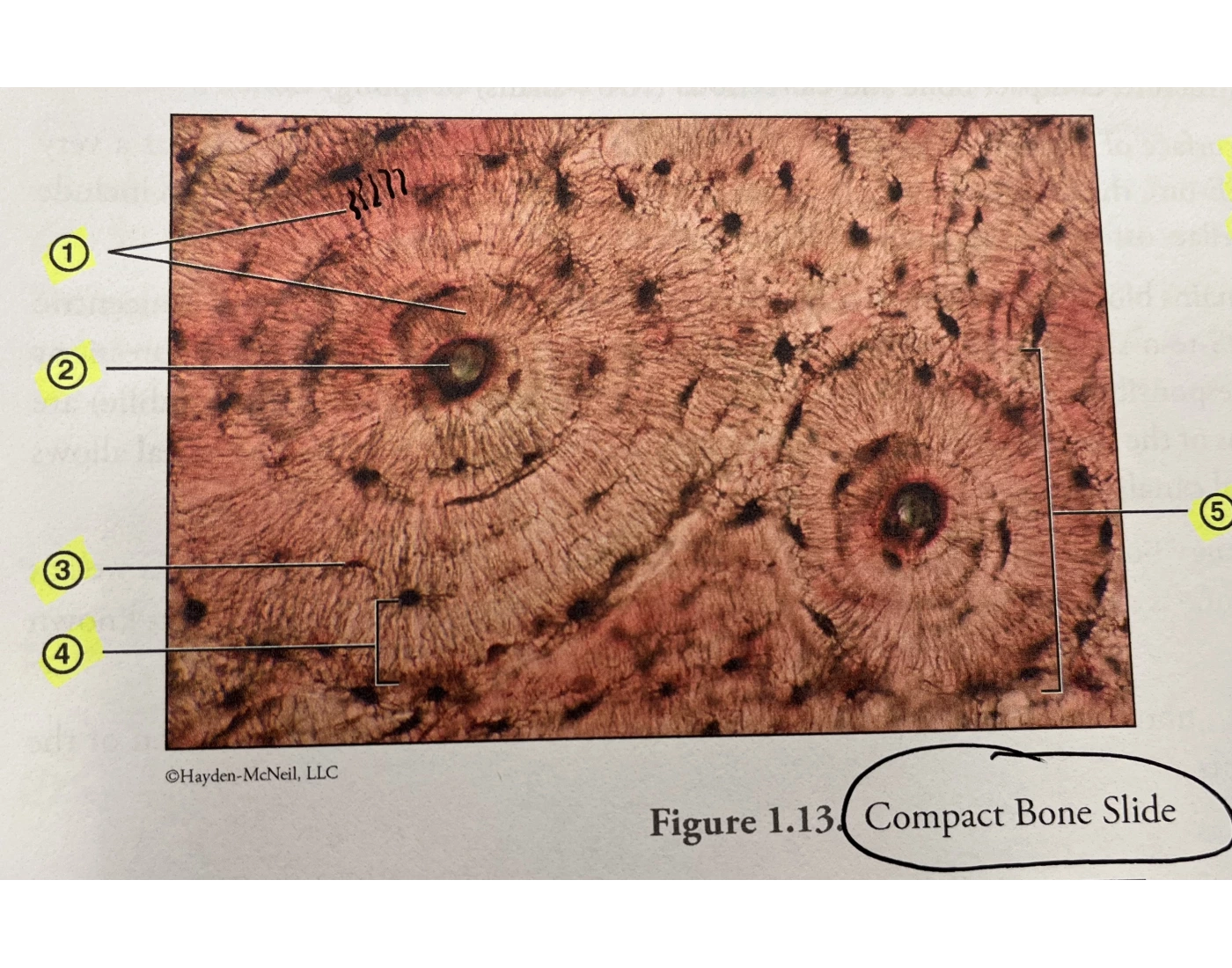 Compact Bone Microscope Slide Compact Bone Slide Quiz