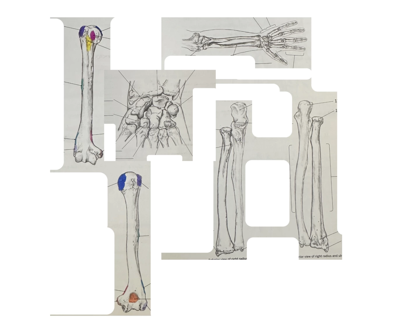 Arm Bony Landmarks Quiz Arm bony landmarks quiz
