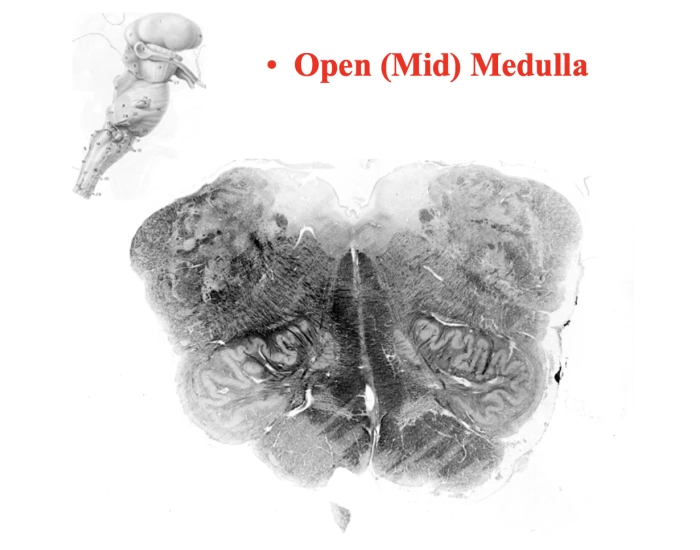 Open Mid Medulla Quiz