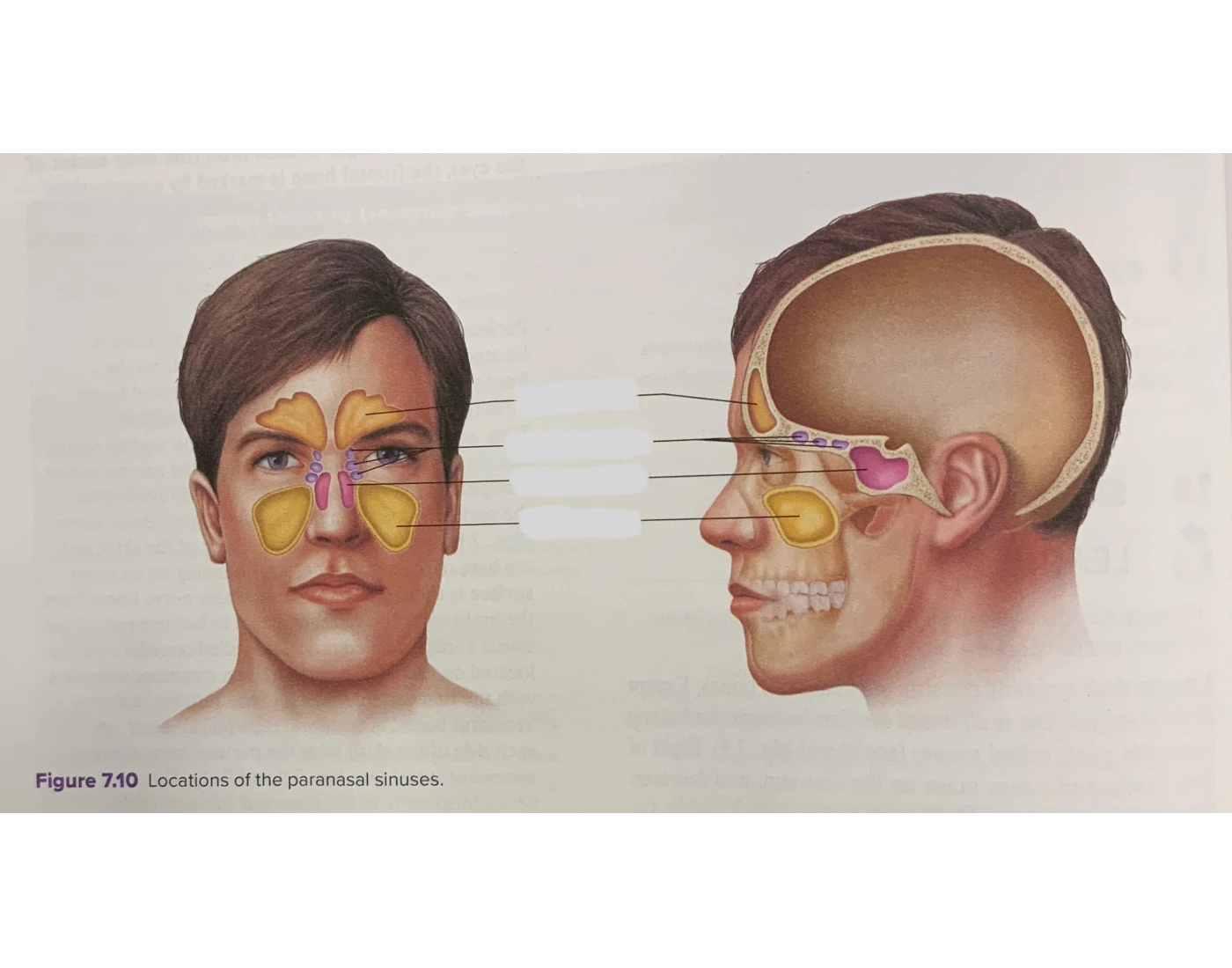 Paranasal Sinuses Quiz paranasal-sinuses-quiz