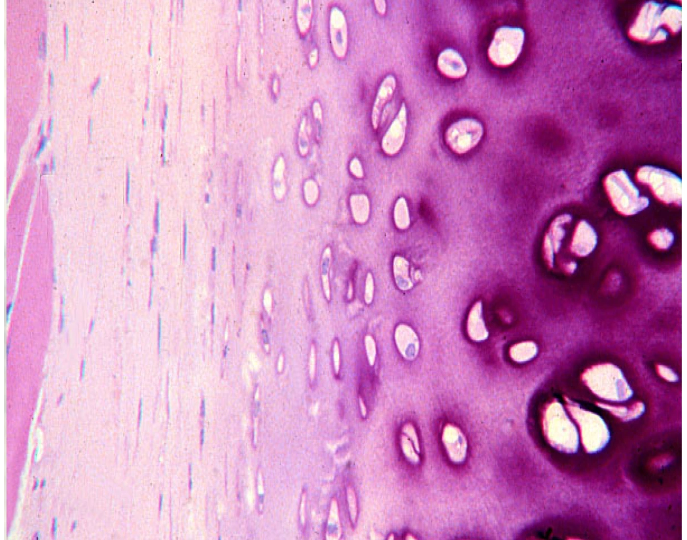 Chondroblast Quiz chondroblast-quiz