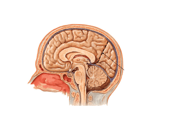 corte sagital del cerebro