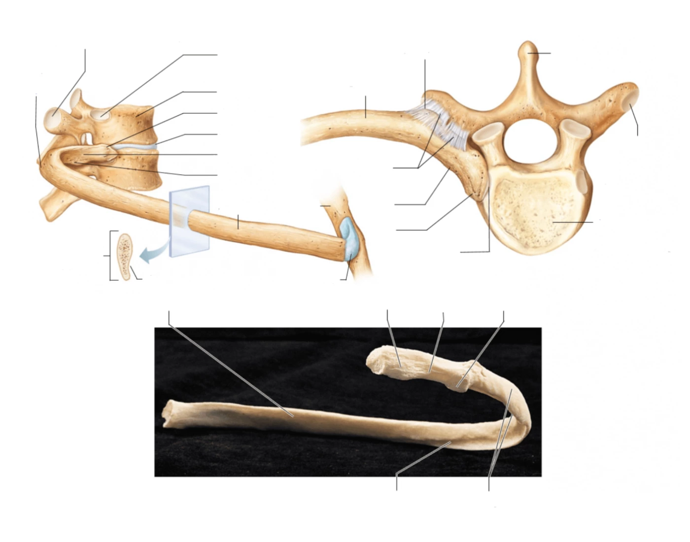Figure 9.20 | True Rib Anatomy Quiz