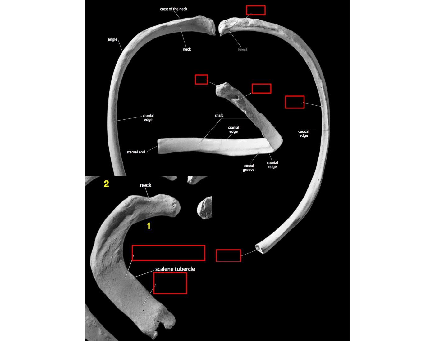 Rib Anatomy Parts Quiz — Printable Worksheet