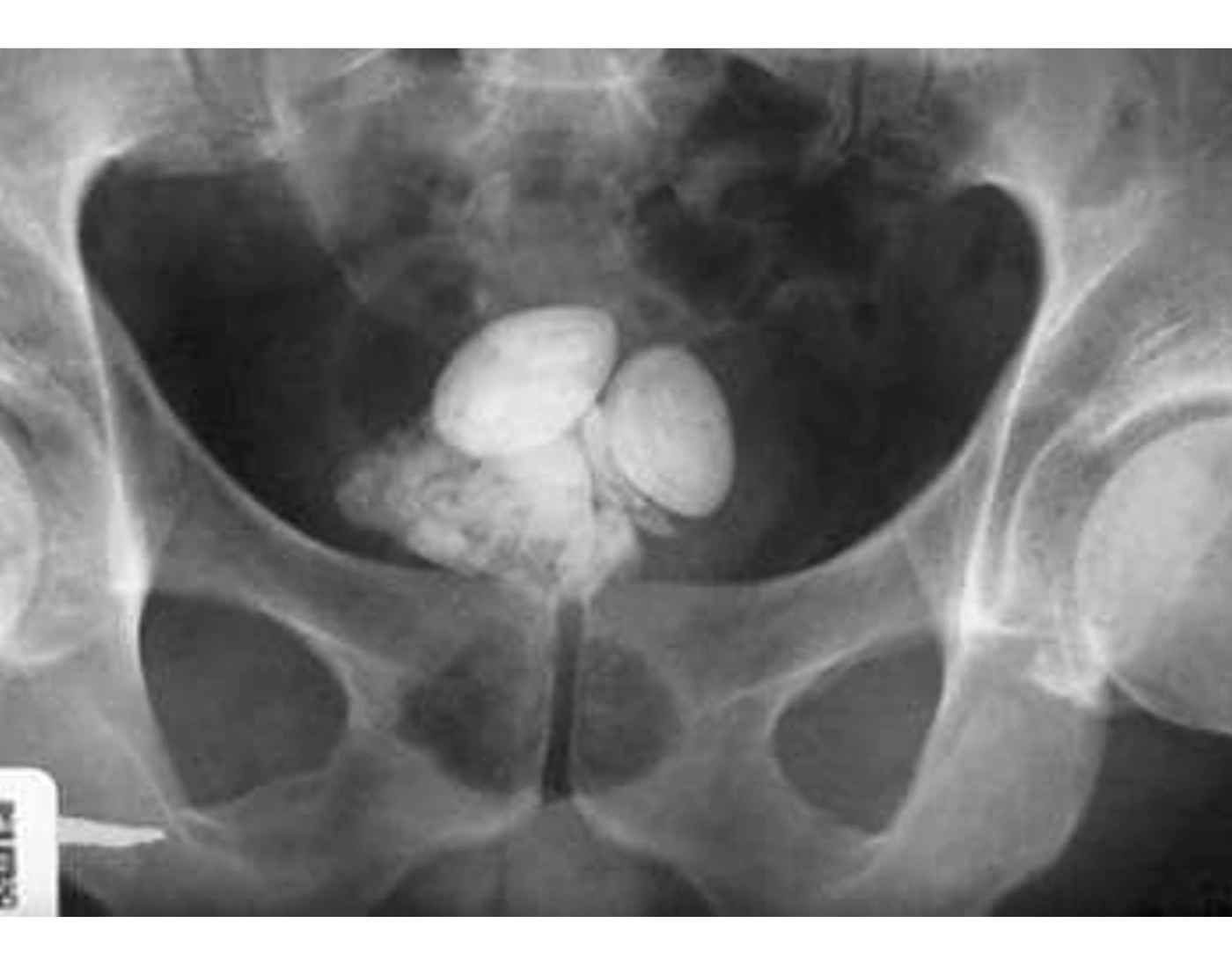 GU Anatomy Quiz gu-anatomy-quiz