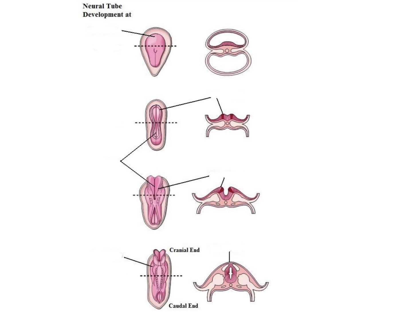 Neural Tube Function Neural Tube Development Quiz
