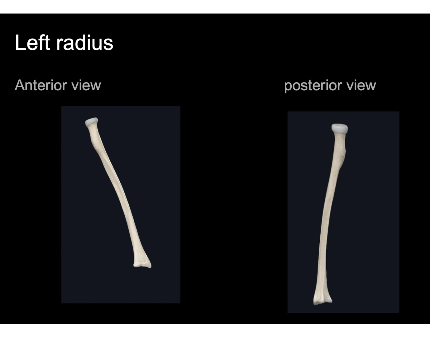 radius bone Quiz