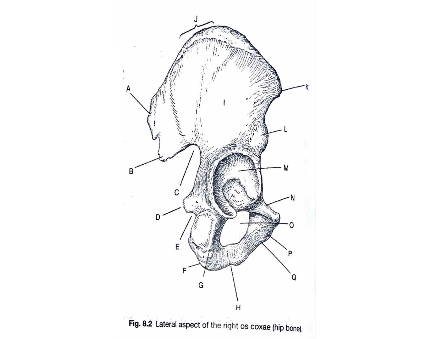 Lateral aspect of the right hip bone Quiz