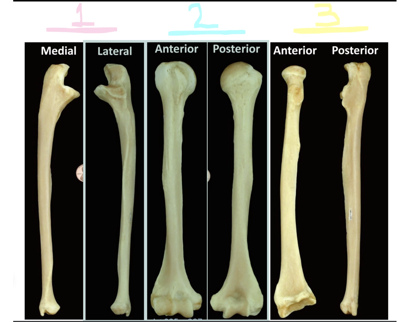 Ulna Humerus & Radius — Printable Worksheet
