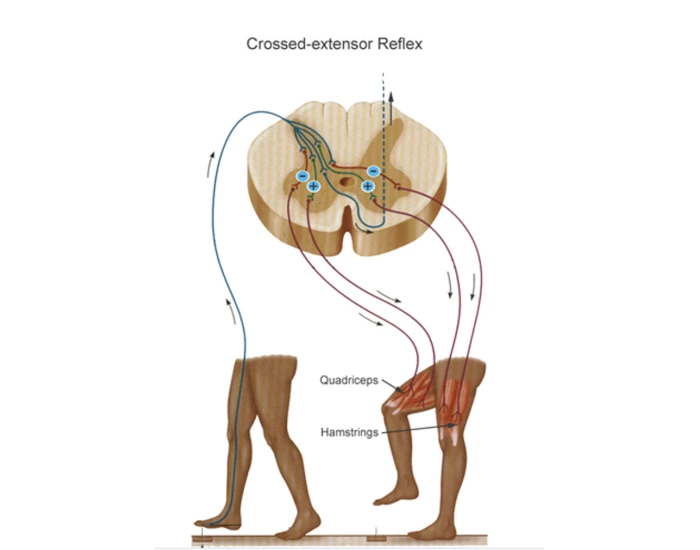 crossed extensor reflex Quiz
