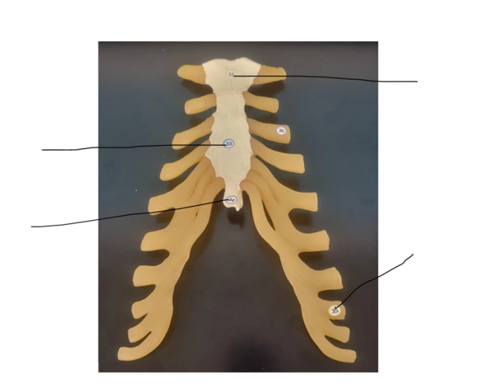 Label The Ribs Quiz