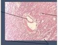 cortico-medullary junction of kidney 