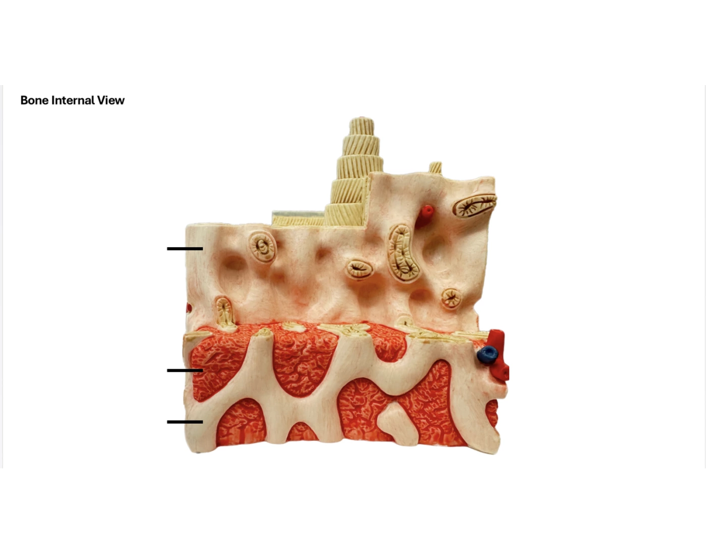 Bone Innerview Bone Internal view Quiz