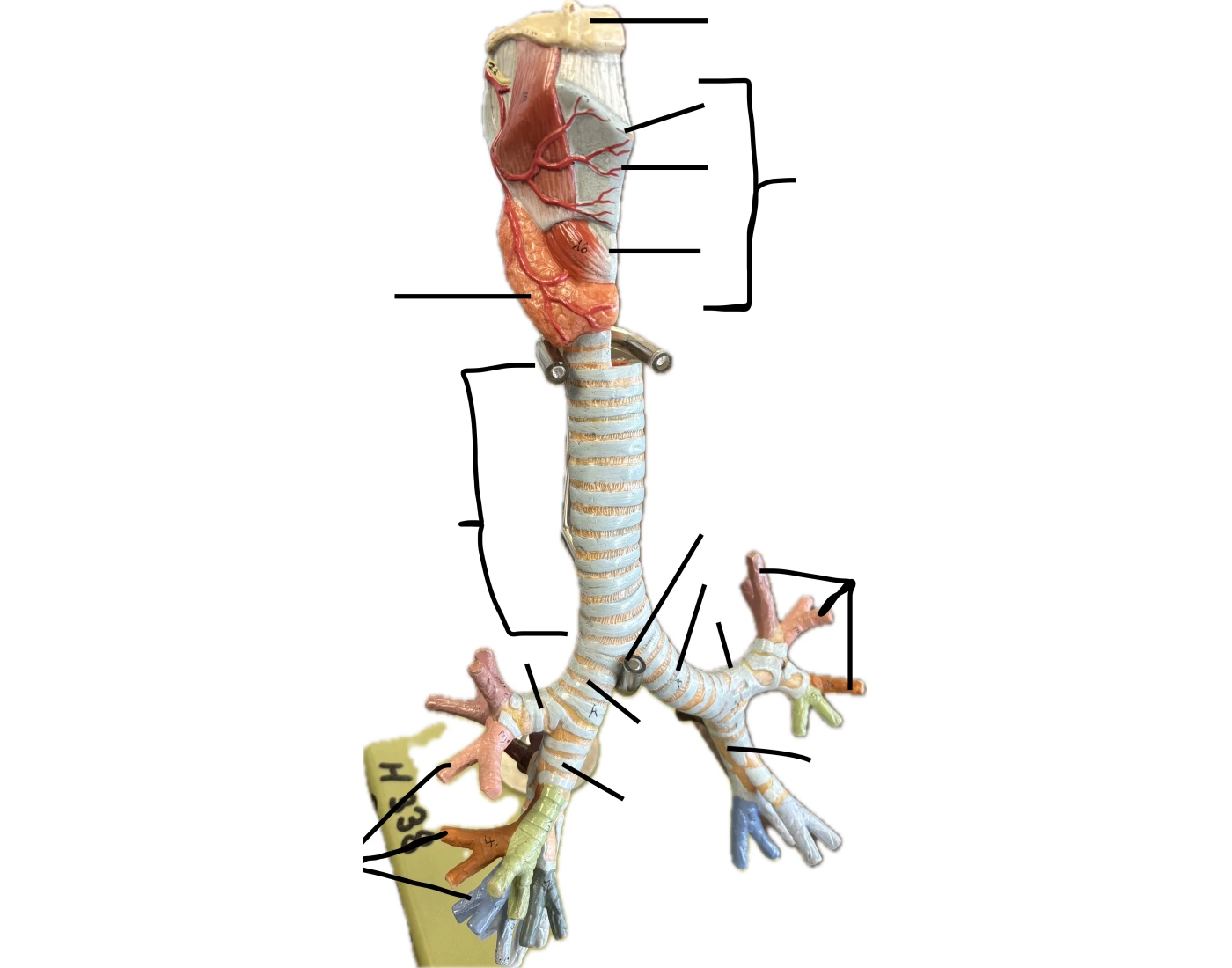 Trachea Lab Model LAB EXAM #2 trachea and bronchial tree Quiz