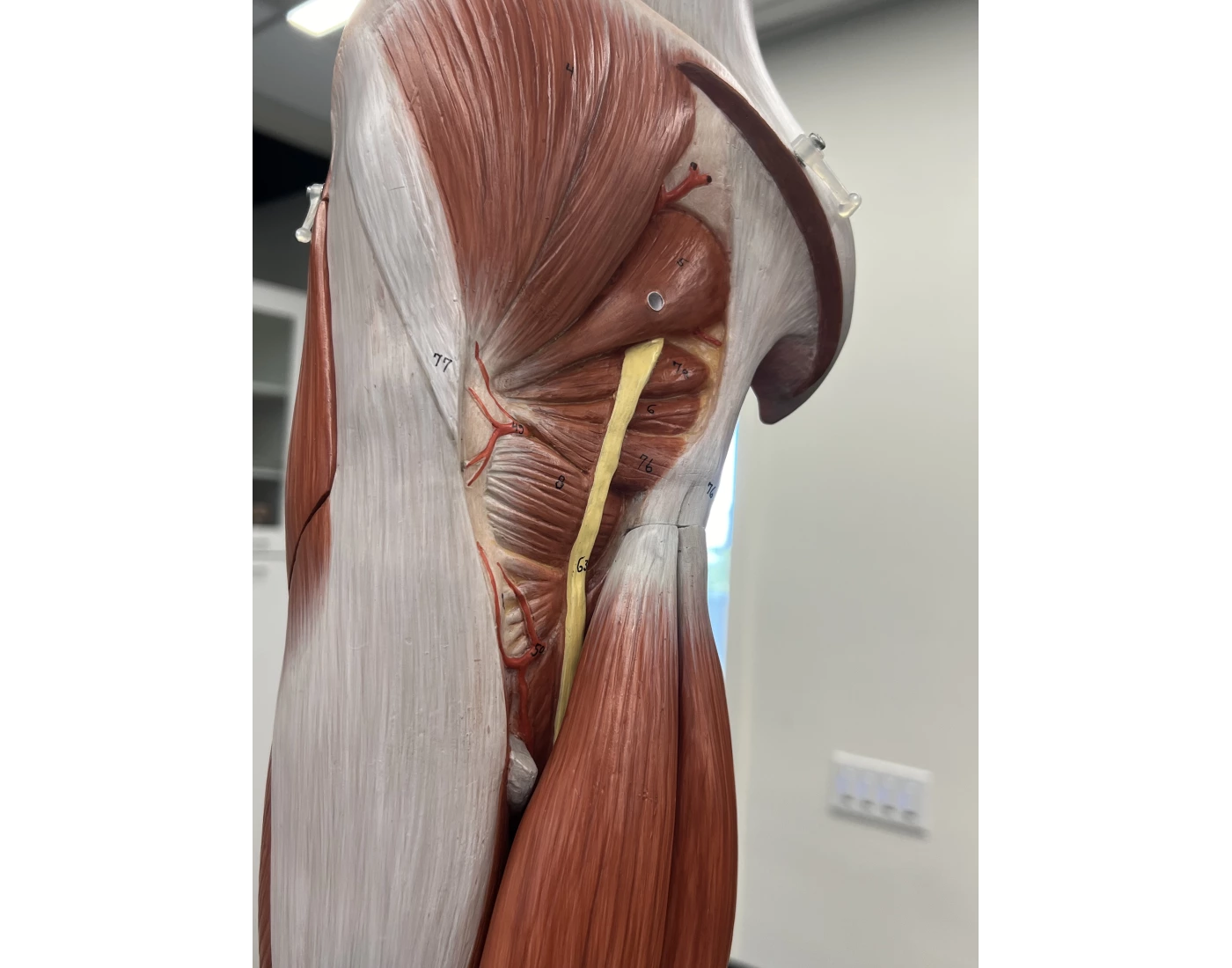 Lateral rotator muscles Quiz