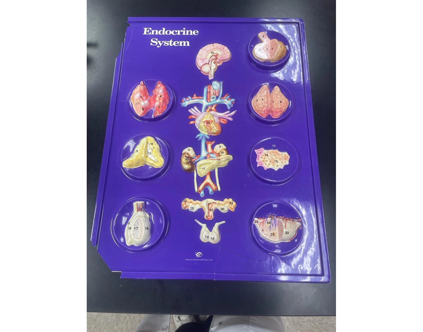 Endocrine System Model Using Garbage Endocrine system model Quiz