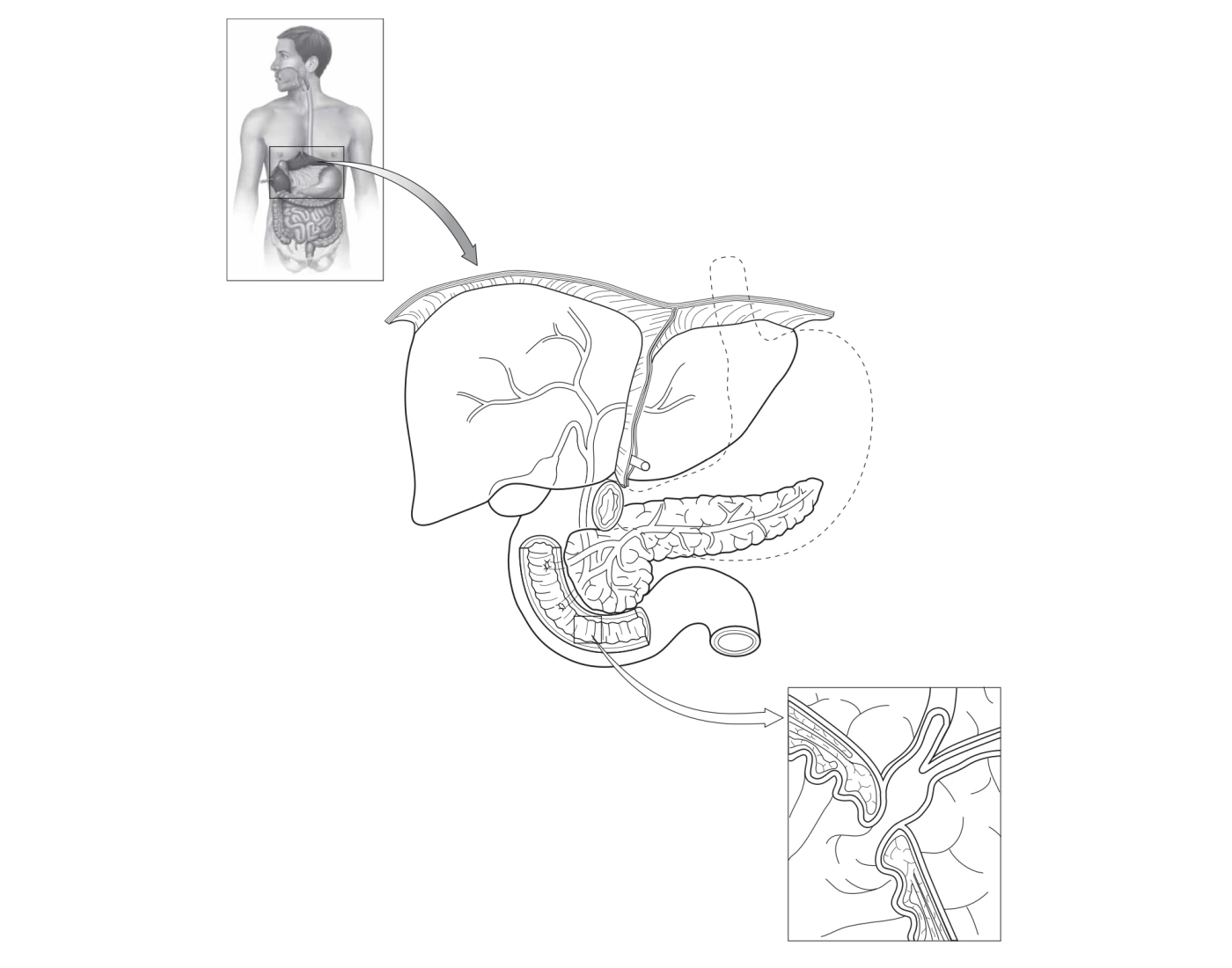 liver-galbladder-pancreas-and-duodenum-quiz