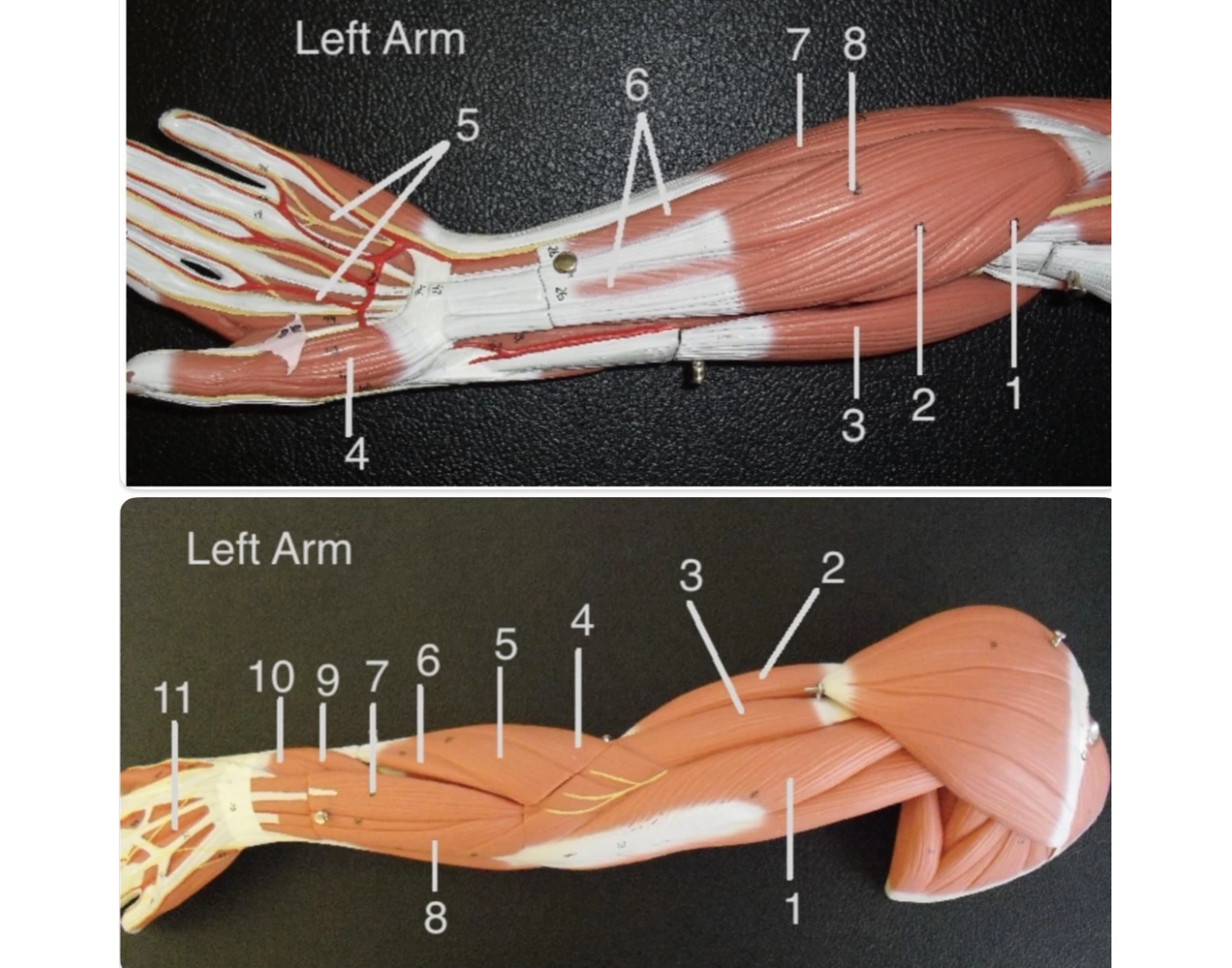 Arm Muscle Model Labeled Quiz